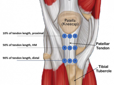 Différences de raideur au sein du tendon rotulien