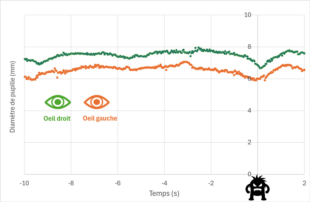 Mesure du diamètre des pupilles droite et gauche pendant la vidéo avec les lunettes d'Eye-tracking VPS 16